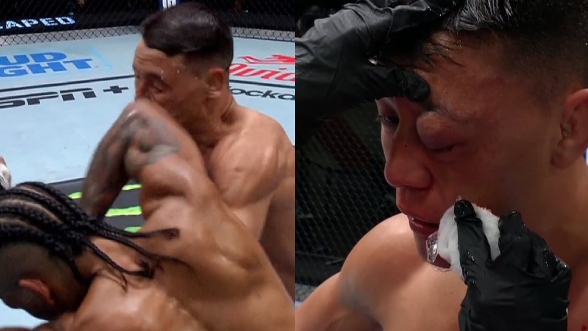 ‘One Of The Grossest Things I’ve Ever Seen’ – Fans React As Vicious Elbow To The Eye Forces Doctor Stoppage In UFC Fight Night Featured Prelim