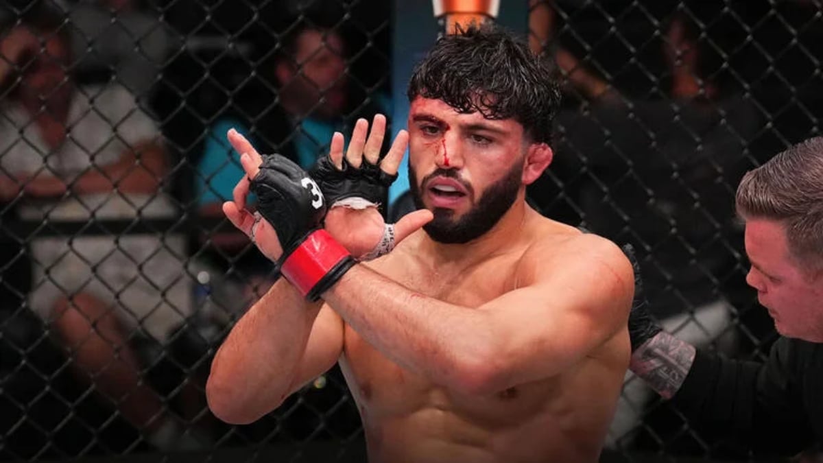 Arman Tsarukyan ‘Couldn’t Move’ After Suffering Back Injury During UFC 311 Weight Cut
