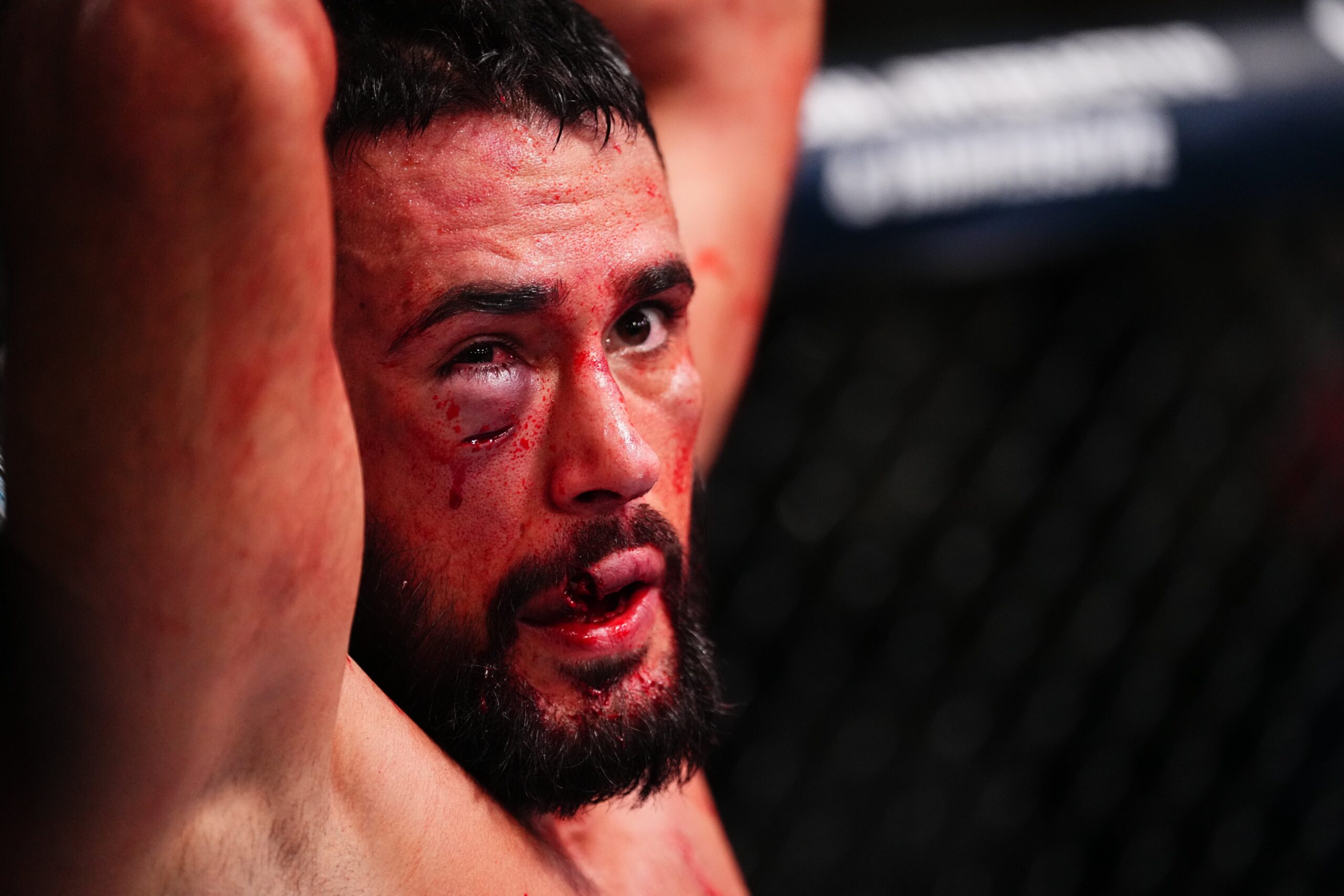 Fans React To Daniel Frunza’s Busted Eye And Lip, Giving Rhys McKee First UFC Win At UFC Vegas 105