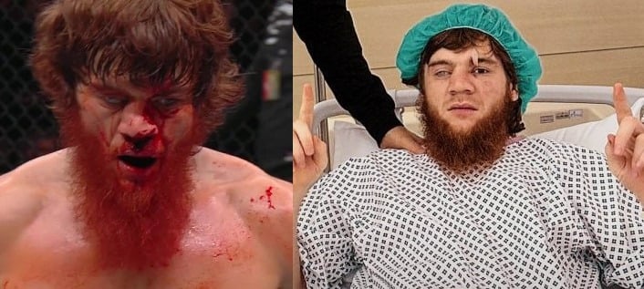 Shara Magomedov In Hospital Recovering From Nose Surgery Following His UFC Abu Dhabi Match