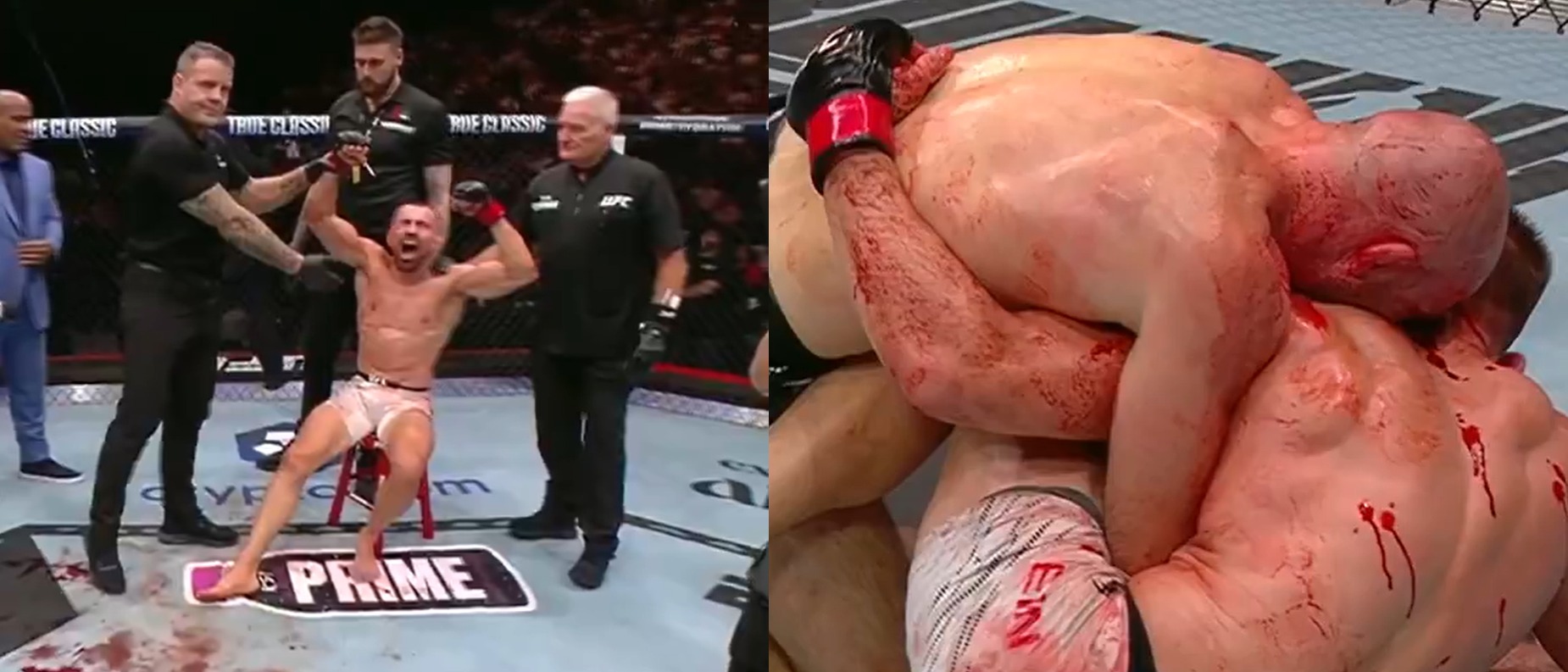 “Give Them Everyone’s Bonuses” – Fans & Fighters React as L’udovit Klein Earns Decision After Bloody War With Mateusz Rebecki At UFC 321