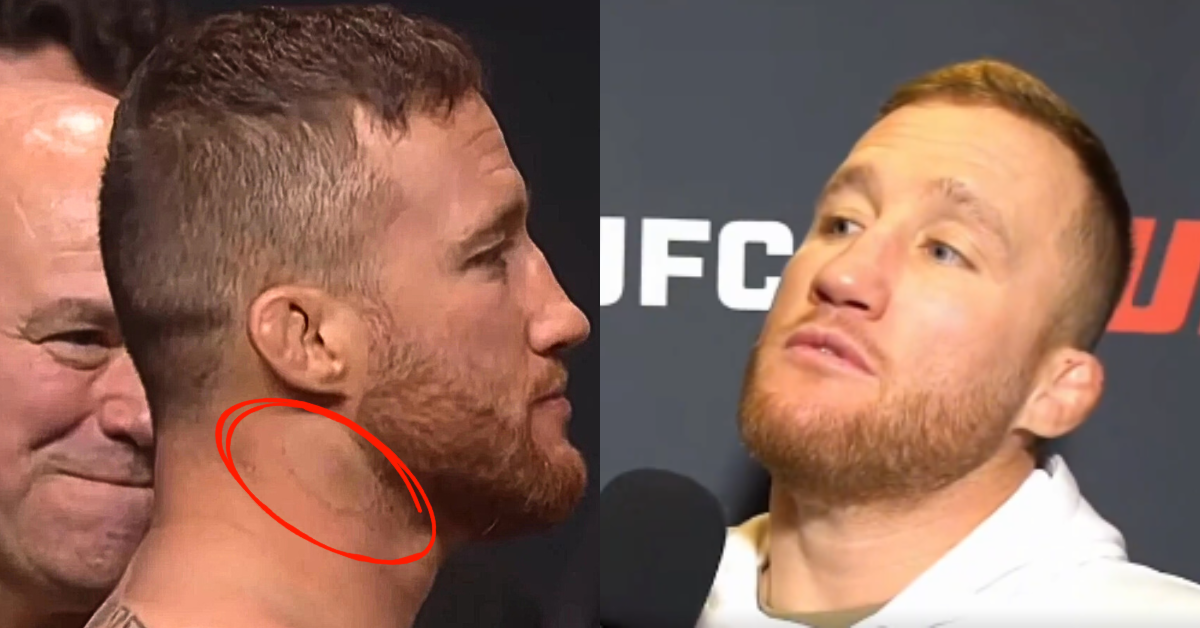 Justin Gaethje Lashes Out at Staph Question: “What’s Wrong With You?”